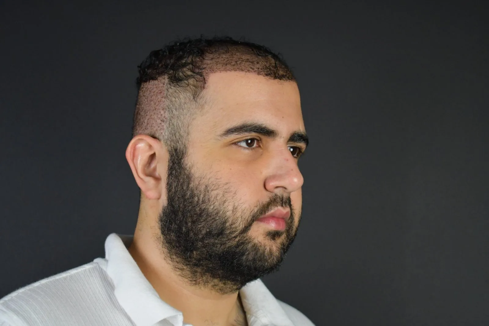Man with beard in profile against dark background
